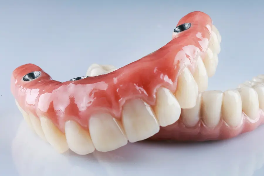 implant dentures